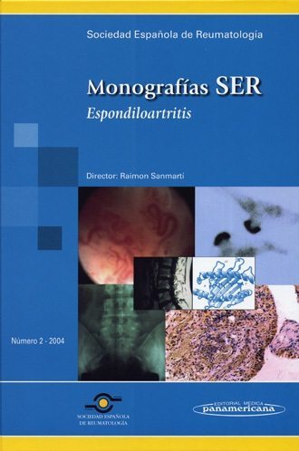 Sociedad Espanola De Reumatologia Monografias Ser Semiologia De Las Enfermedades Reumaticas Medica Marquet